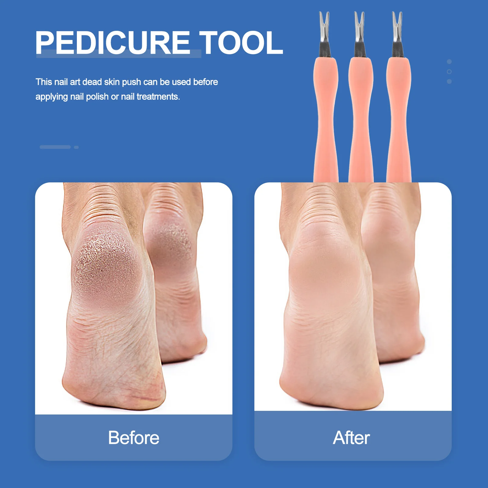 5 قطعة انتهازي للبشرة المتقلب مزيل الجلد الميت مكشطة مسمار طقم أدوات المهنية مانيكير اكسسوارات إهاب انتهازي أداة #6