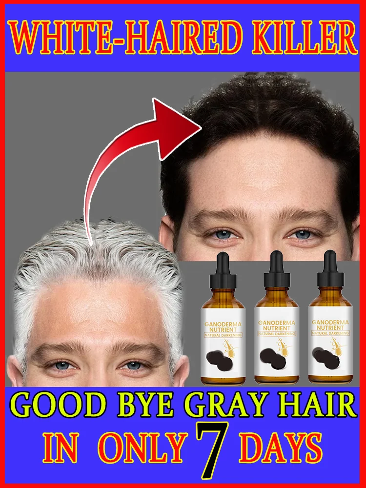 Gray White Hair Treatment Serum Liquid White To Black Natural Color Repair Nourishessence Anti-gray Anti Loss Care Men Women