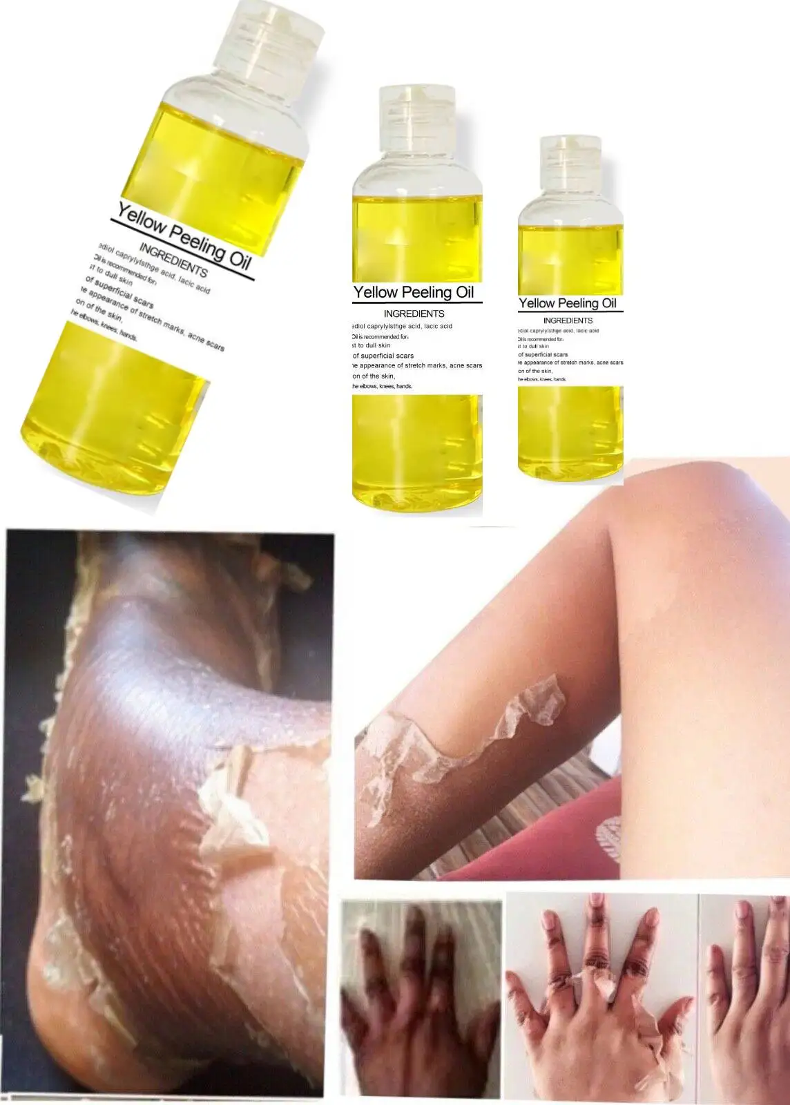 Yellow Peeling Oil- Extra Strength Rough Tough Skin Lightening Rejuvenating 30ml Strength Yellow Oil Peeling