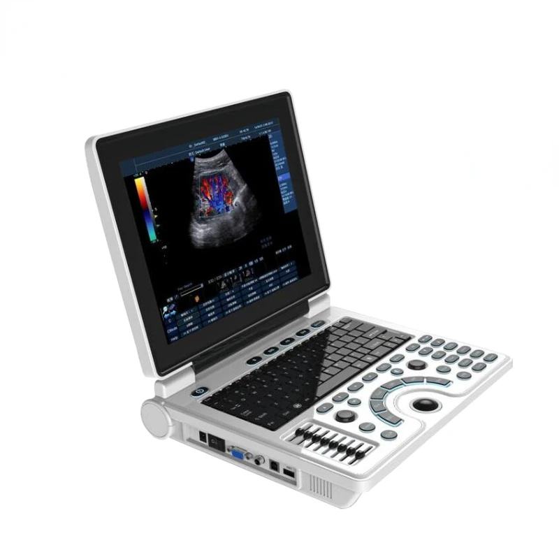 Laptop Ultrasound Scanner Diagnostic System medical ultrasound scanner Notebook Style Medical Ultrasound