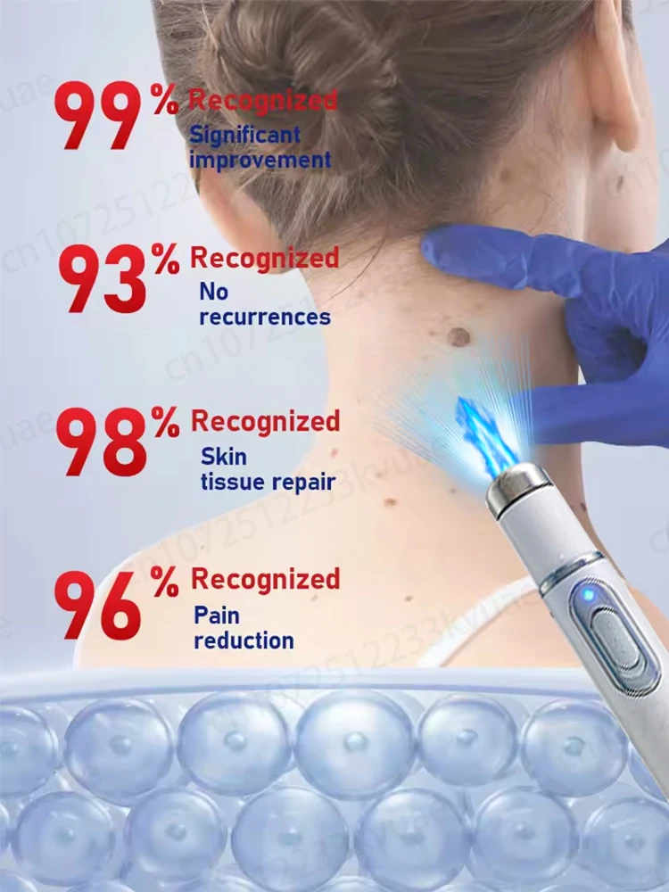 Blue light wart tool, more discounts on sets