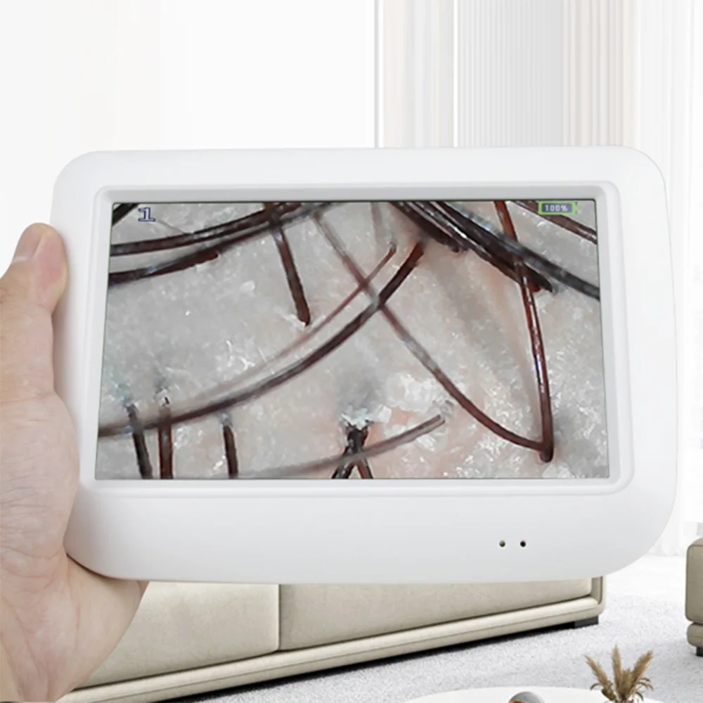 Sistema di diagnosi della pelle digitale con schermo LCD da 5 pollici Analisi dell'analizzatore dei capelli Ricaricabile portatile