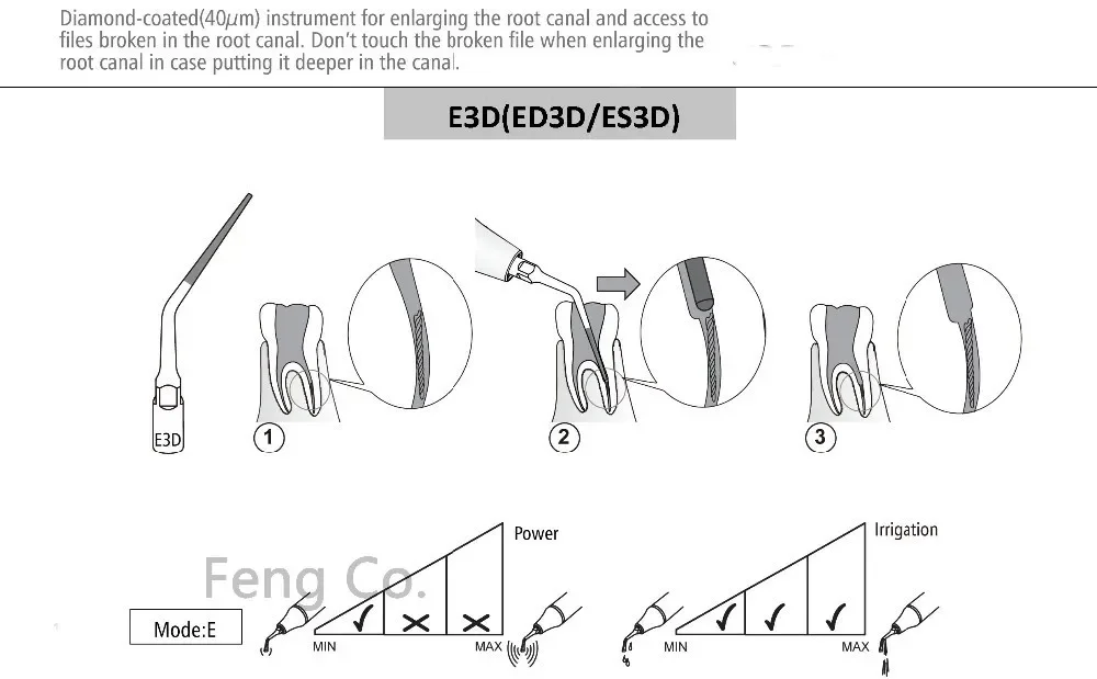 Puntas de escalador ultrasónico E3D, escalado Dental Endo Perio, compatible con EMS, pieza de mano de pájaro carpintero, instrumento de odontología