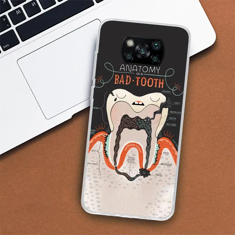 Wisdom Teeth Dentist Tooth Phone Case For Xiaomi Poco X7 X6 X5 X4 X3 Nfc F6 F5 Pro F4 Gt F3 F2 F1 M5S M4 M3 5G Fundas Soft Shell