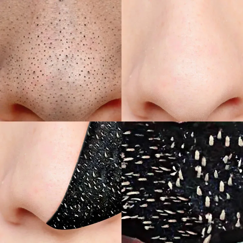 5/30pcs Nose Blackhead Remover Mask Deep Cleansing Skin Care Shrink Pore Acne Treatment Mask Nose Black dots Pore Clean Strips