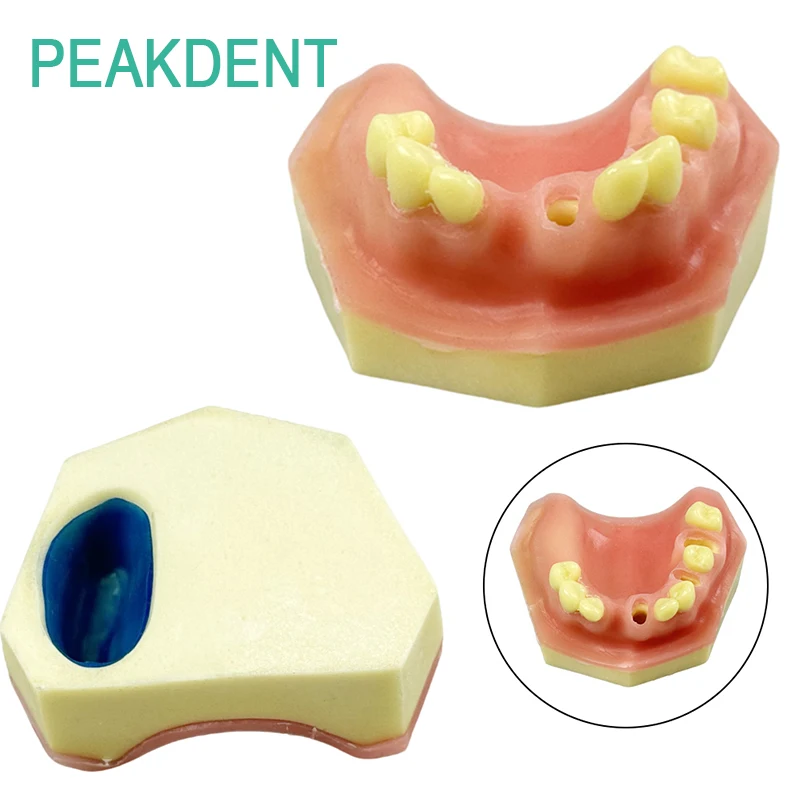 

Модель зубного имплантата Имплантат верхнечелюстной пазухи Модель отсутствия зуба Модель стоматологии Студенческие исследования полости рта и обучающая модель
