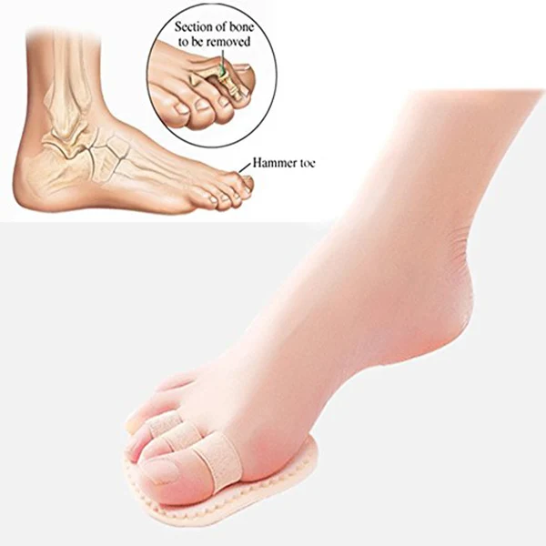 

Toe Correction Pad for Men Women Brown Mallet Overlapping Straightener 3 Toe Spreader Foot Care Tools Lightweight Durable