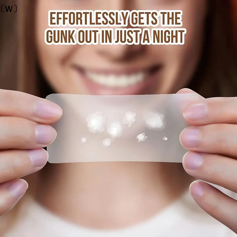 

tipoW Vissreat 30 PCS/SET Пластырь от прыщей Невидимые средства для удаления прыщей Уход за кожей Наклейки Консилер Пятно для лица Красота WasserWinter1 markii