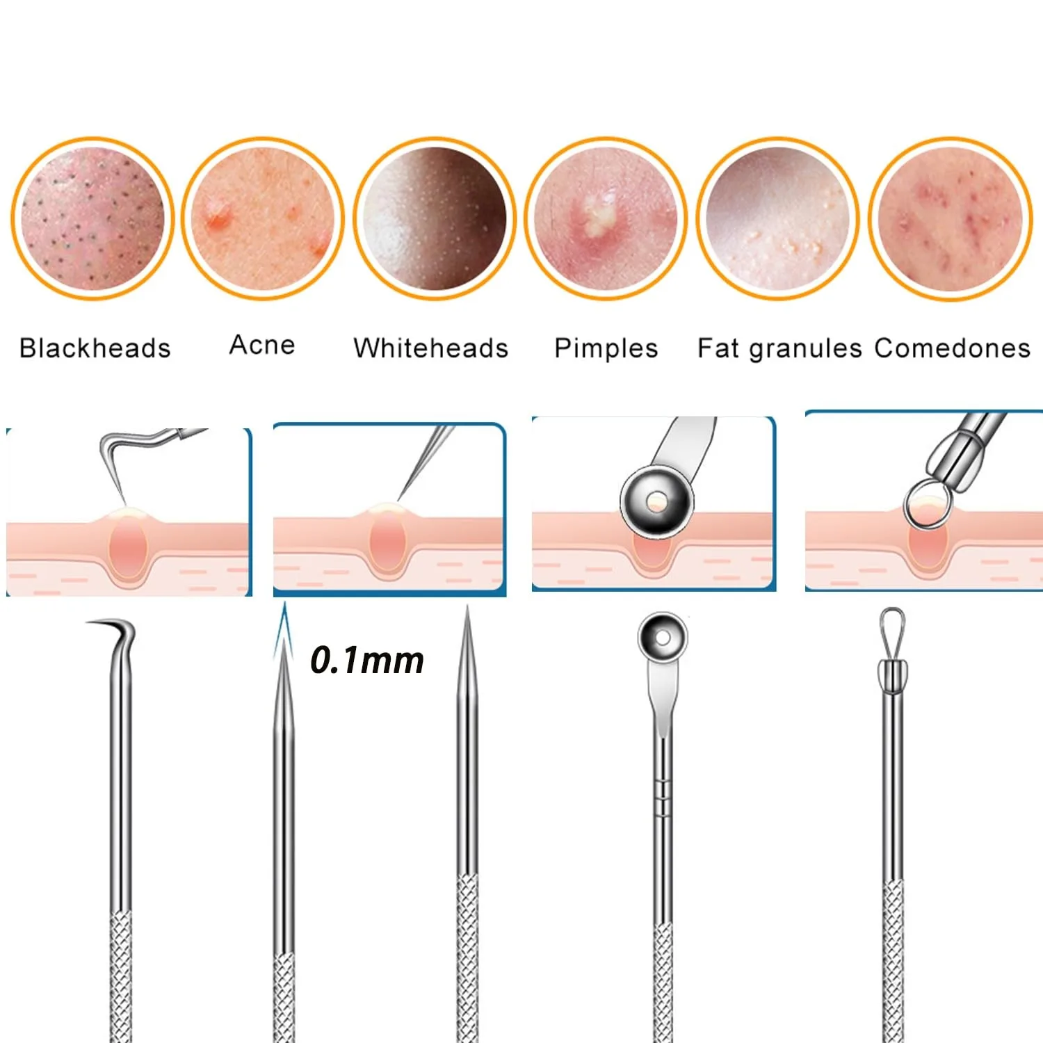 1/3/6/8 pçs de aço inoxidável acne clipe removedor cravo pinça extrator espinhas acne agulha facial salão beleza ferramentas cuidados com a pele