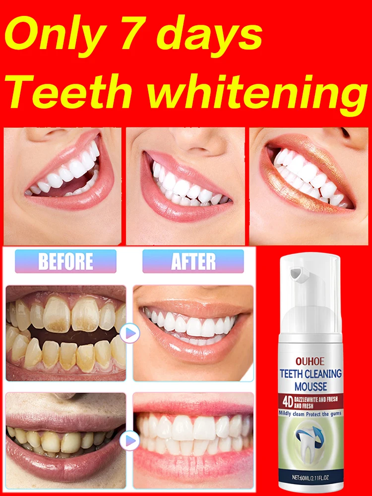 

Teeth Whitening Mousse Deep Cleaning Cigarette Stains Repair Dental Plaque Fresh Breath