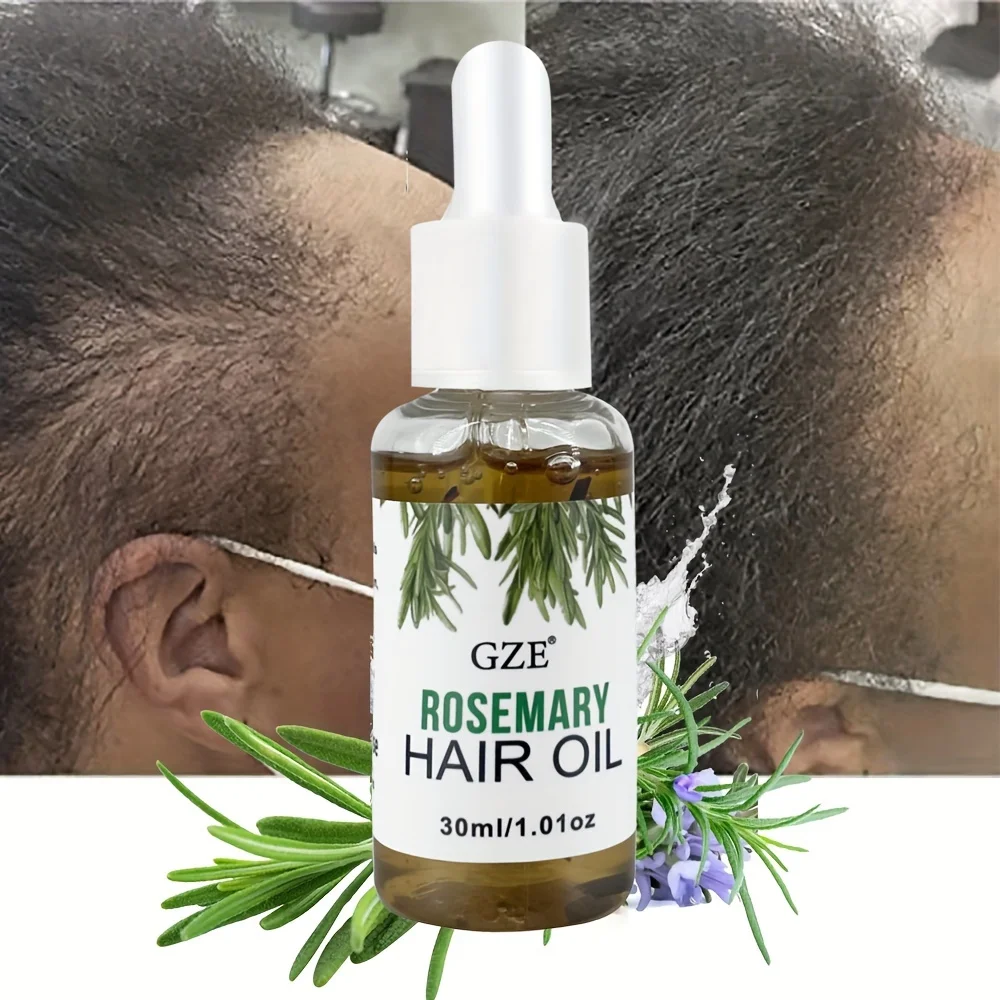 GZE Rosemary Oil For Hair Growth Rosemary Scalp Hair Growth Oil, Infused Biotin to Encourages Hair Growth | Healthier, Stronger