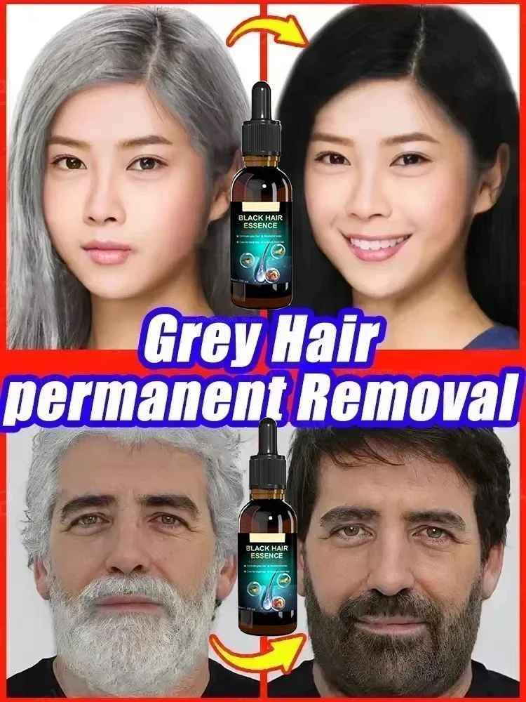 

White Hairs Care - Grey hairss essence Serum Natural Gray White Hair Essence Repair Nourish Anti Loss Hair Care for Men Women