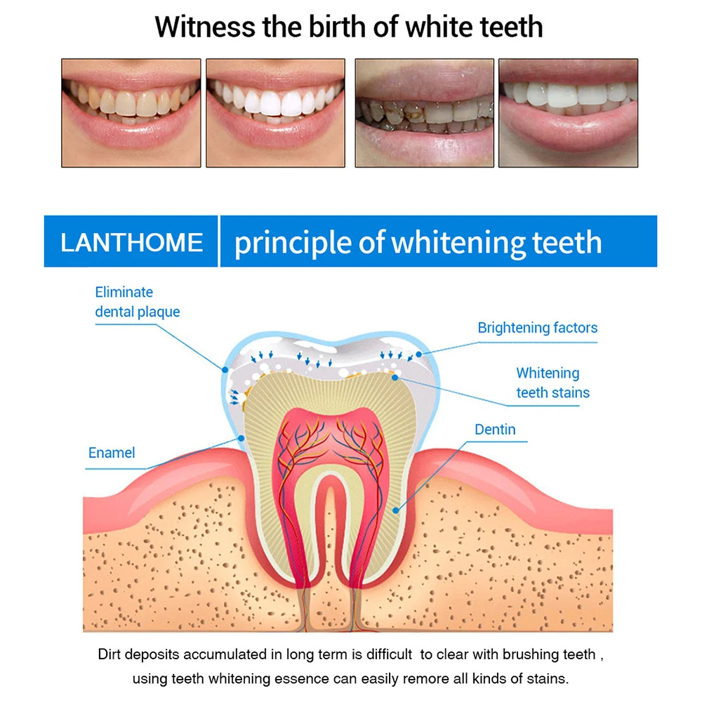 1/3 pces gel de peróxido limpeza dos dentes pessoal dentes branqueamento caneta dente branqueamento natural gel dental ferramenta de cuidados