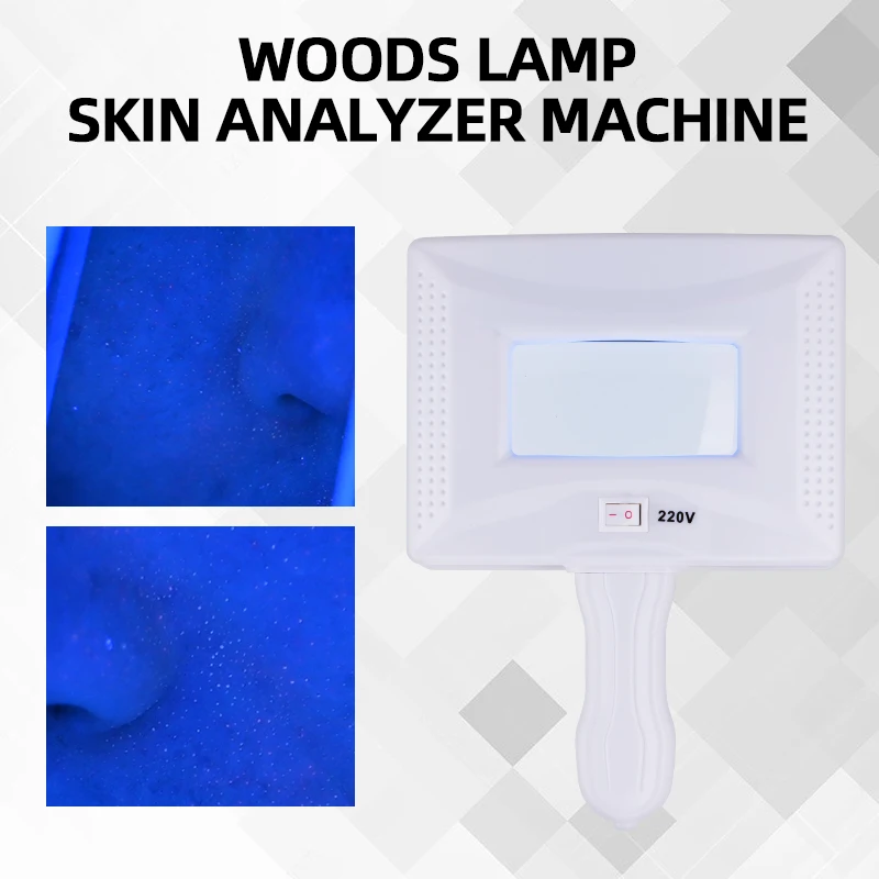 Analyseur de peau de Machine d'analyse de peau de lampe de bois pour la détection fongique, la pigmentation et la diagnostic de l'acné moniteur effets de soins de la peau