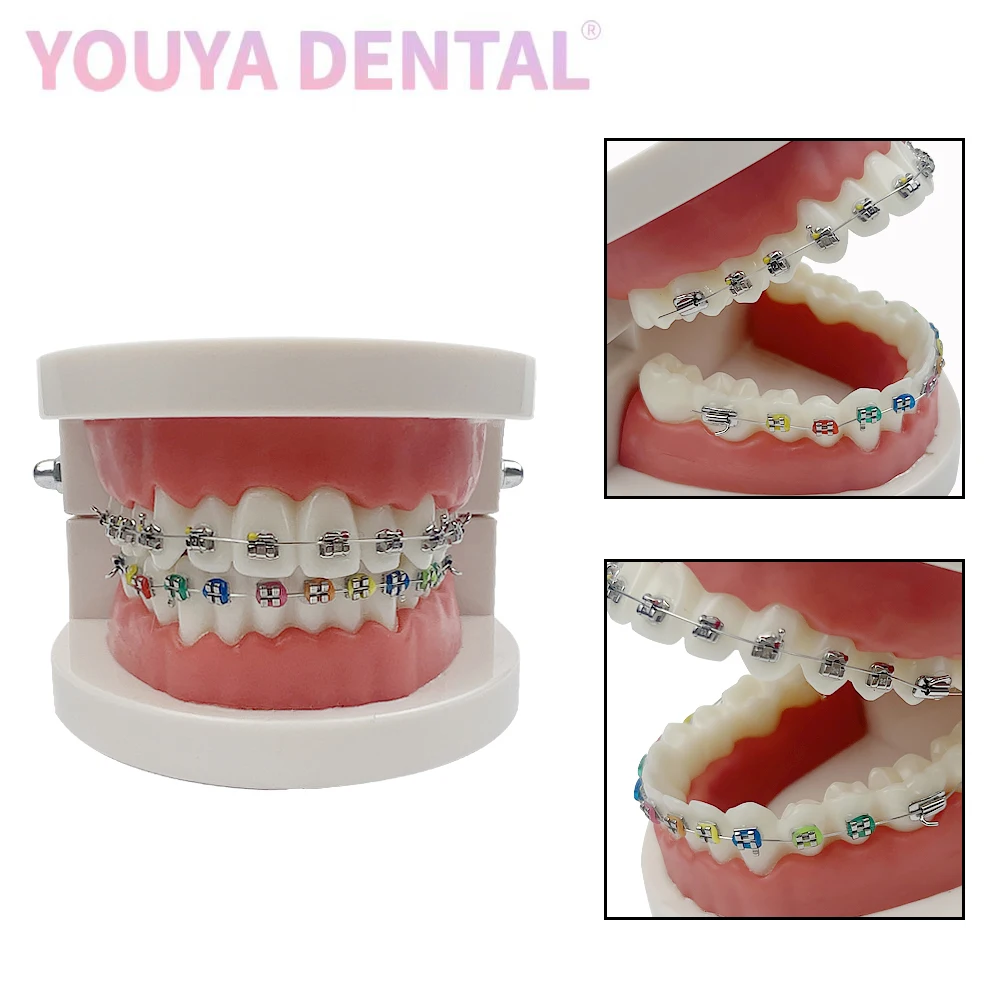 1pc 28-Teeth Standard Tooth Model Orthodontic Tooth Model With Metal Self-Ligating Brackets Ceramic Bracket Teaching Tooth Model