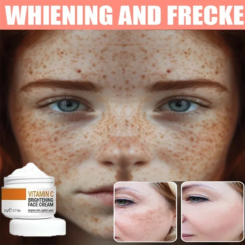 

Freckle Removing Essence Whitening&Lightening Spot Essence Lighten Chloasma Replenish Water Beautify Skin Moisturizing Serum