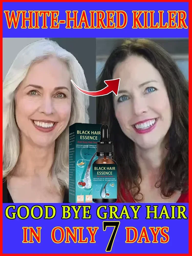 

Turn white hair into black hair, remove white hair, turn gray within 7 days, restore natural health