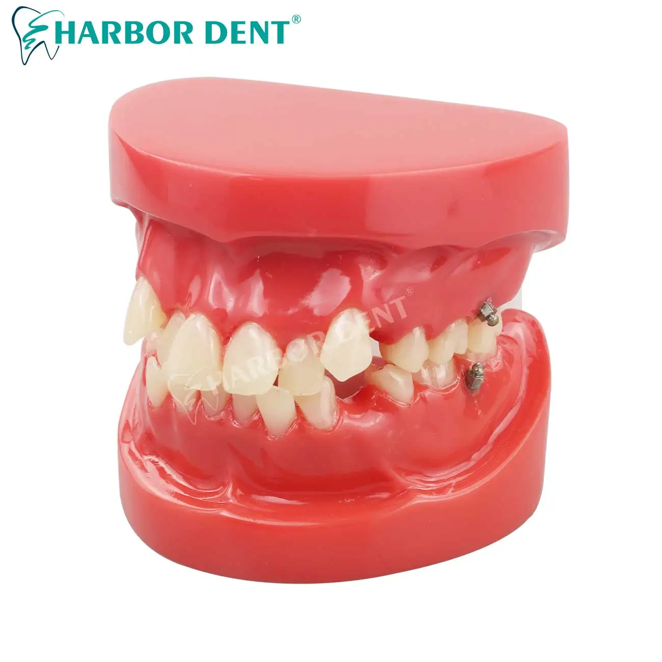 Dental Orthodontic Treatment Teeth Model Malocclusion Correction With  Teach Models for Patient Communication