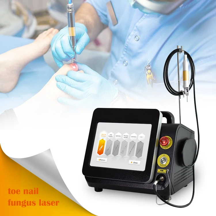 2023 model 4 in 1 laser diode nail fungus laser treatment device nail laser fungus treatment