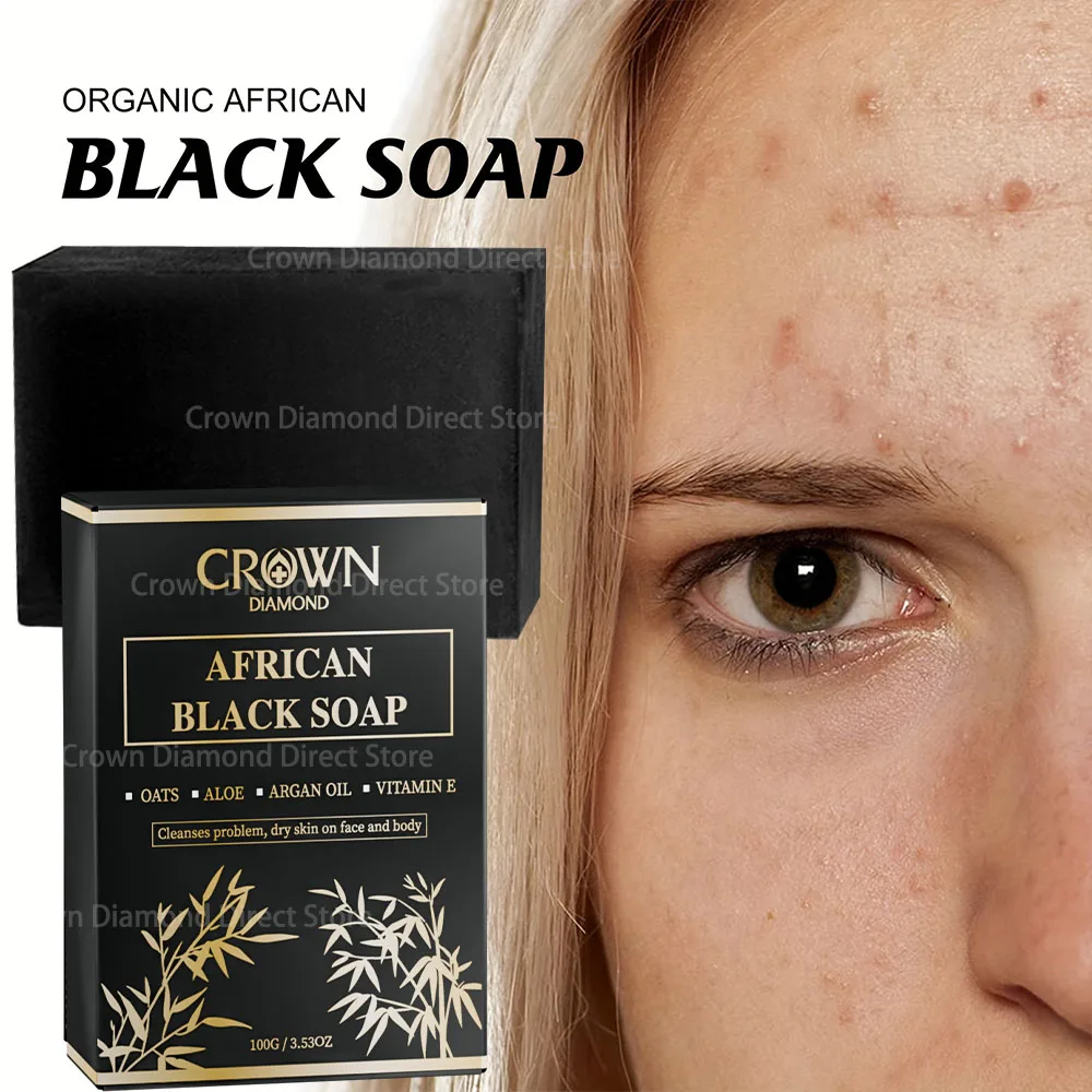 100g Afrika Siyah Sabun Akne Tedavisi Derin Temizlik Pul Pul Yüz Nemlendirici Cilt Pürüzsüzleştirici Yüz Sabunu Cilt Bakımı için