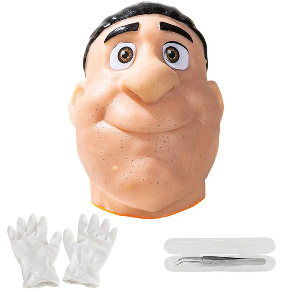 لعبة تخفيف الضغط والتنظيف للرؤوس السوداء، نسخة مطورة لحب الشباب، يمكن أن تحل محل حب الشباب المنفجر