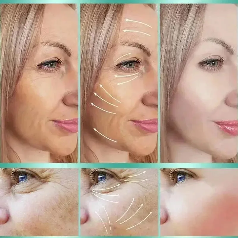 Kollagén Protein Szálakra bont Folyó hó Összeráncol Folttisztószer Vérsavó állítsa Emelés firming Oldódó absorbable arca Fillér anti-aging Reve érdekel