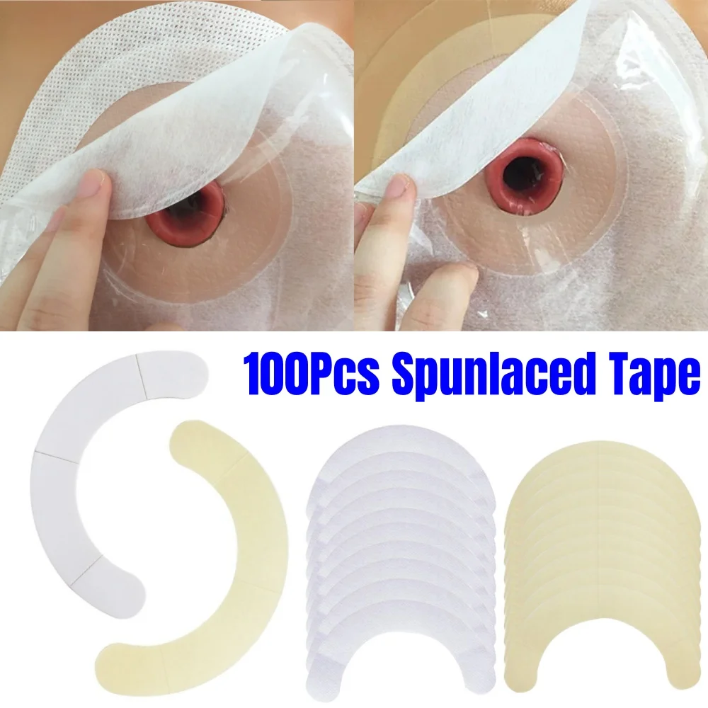 100Pcs Portable Elastic Ostomy Barrier Strips Hydrocolloid Waterproof Leak Skin Adhesive Ostomy Barrier Tape for Colostomy Bag