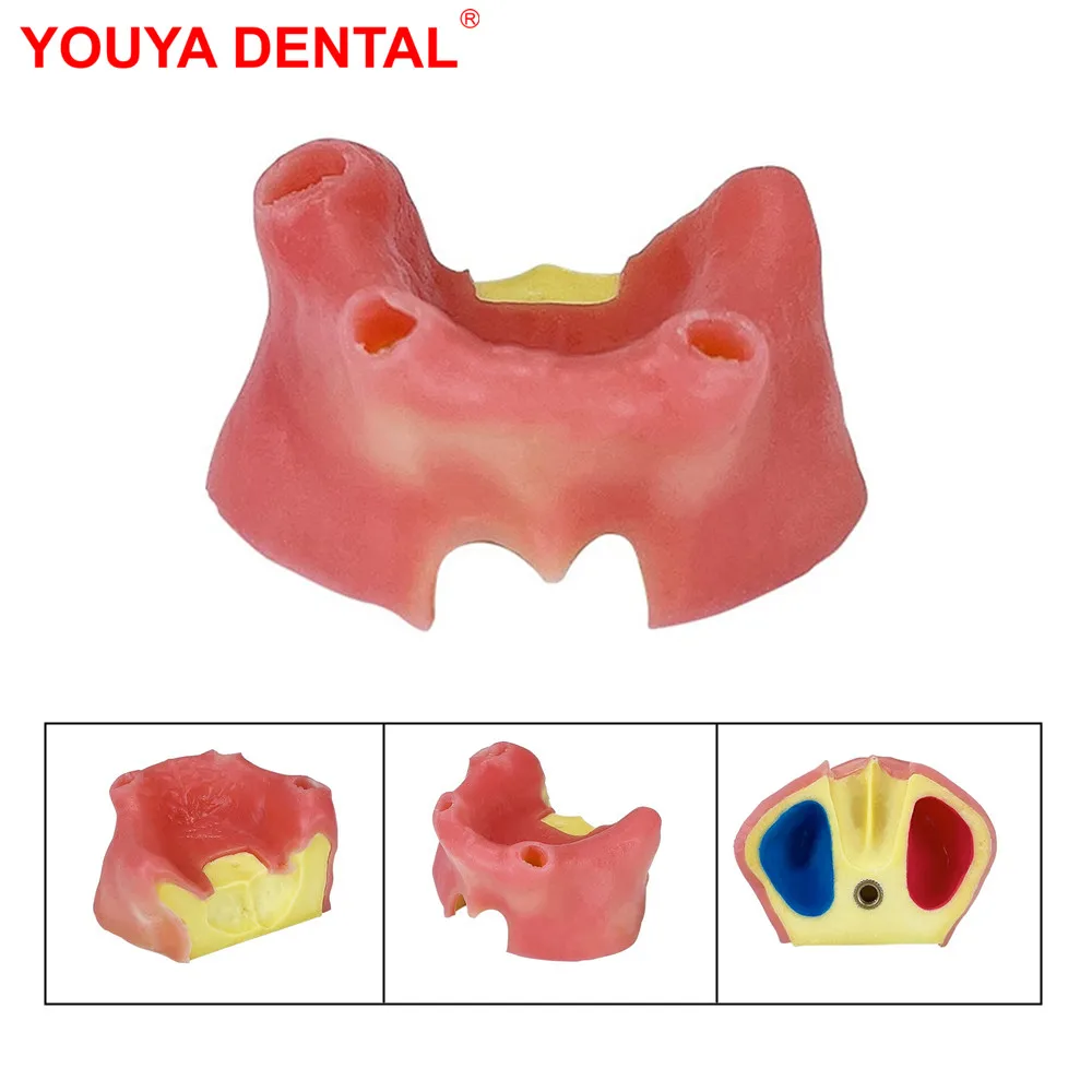 1pc Dental Teeth Model Implant Practice Model With Soft Gums Toothless Maxillary Sinus Model For Studying Training Teaching Demo