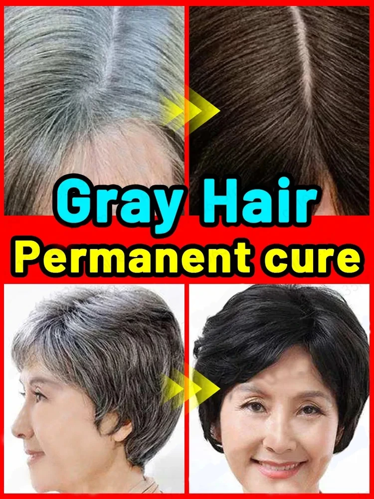 The most powerful black technology in 2024！ completely solve the problem of Anti gray hair