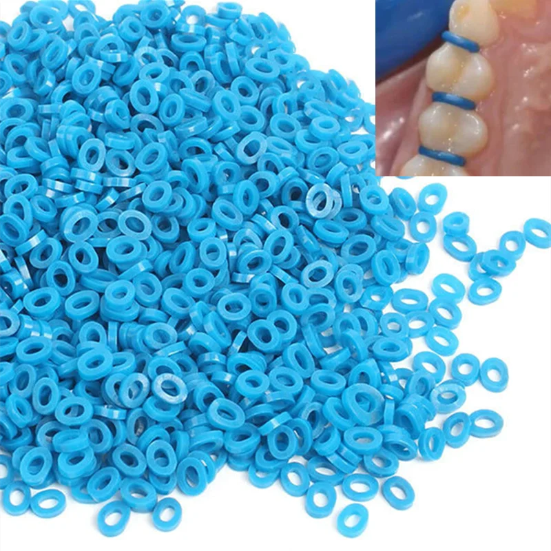 1000Pcs Dental Separator Ligature Ties Ortho Rubber Band Ligature Ties Rings Blue Teeth Elastic Separate Spacers