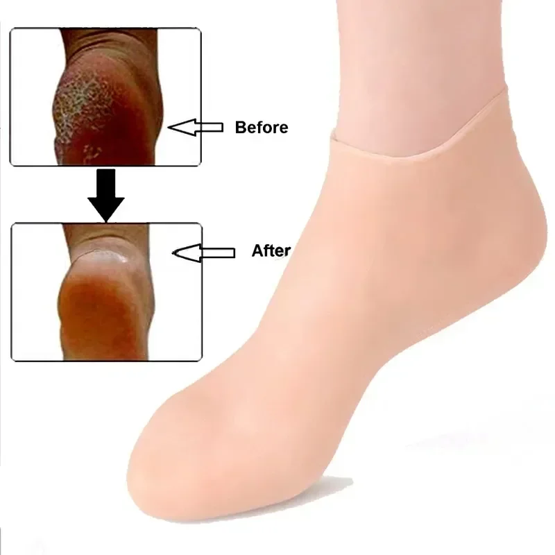 1 Pair Silicone Moisturizing Socks Exfoliating Gel Heel Socks Callus Cracked Dead Skin Remove Protector Pain Relief Foot Care