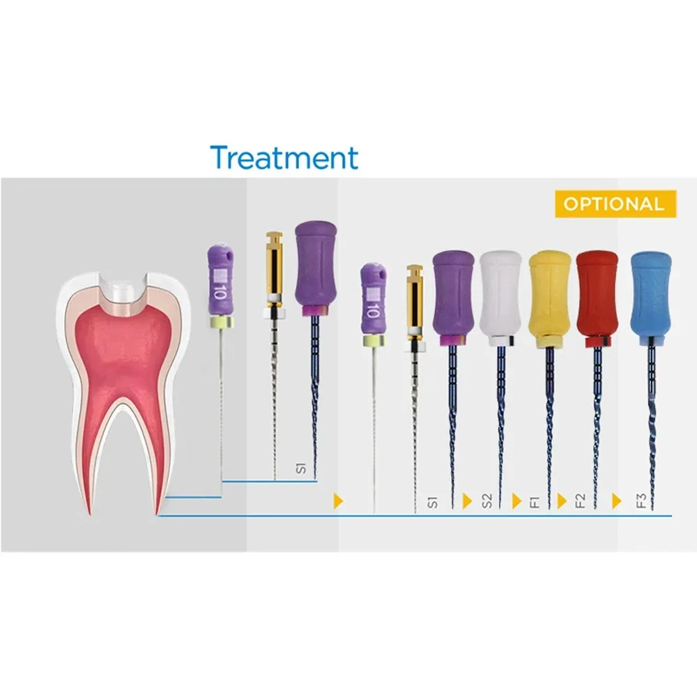 6Pcs Dental NiTi Root Canal Preparation Files, Manual Large Taper Heat Activated Files for Endodontic Enlargement