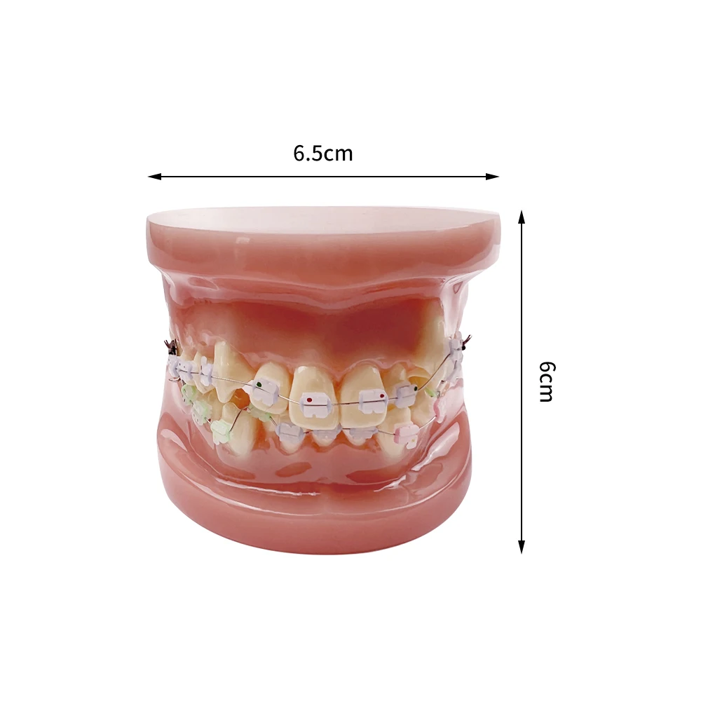 Dental Demonstration Model Orthodontic Treatment Teeth Model With Ceramic Brackets For Patient Education Studying Teaching Tools