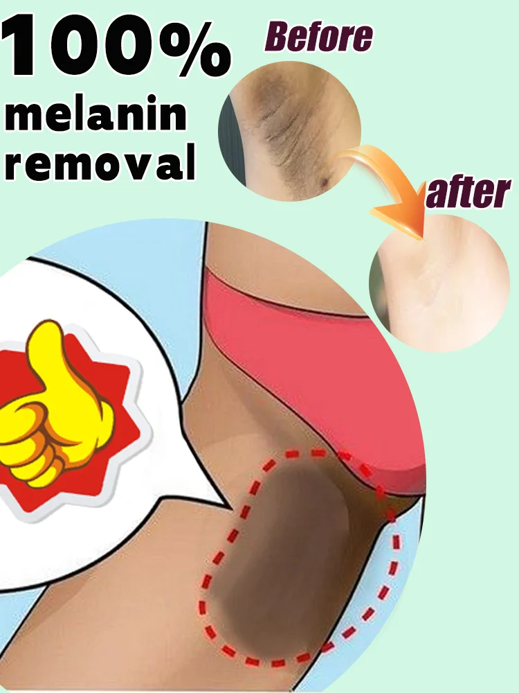 

ᴺᵉʷ ᵗʳᵉⁿᵈ ᵒᶠ ᵖʳⁱᵛᵃᵗᵉ ʷʰⁱᵗᵉⁿⁱⁿᵍSay goodbye to dullness and restore radiance