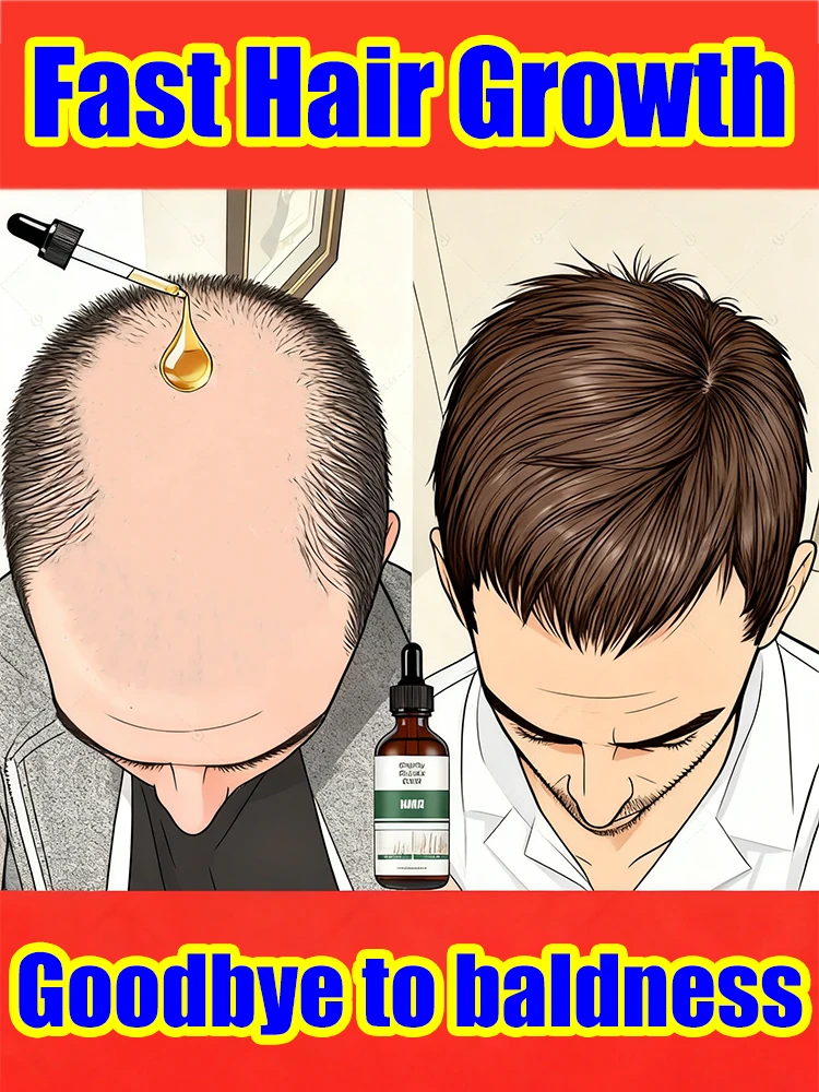 Baldness savior, easily restore your thick black hair, regain your confidence, and return to the peak of unemployment