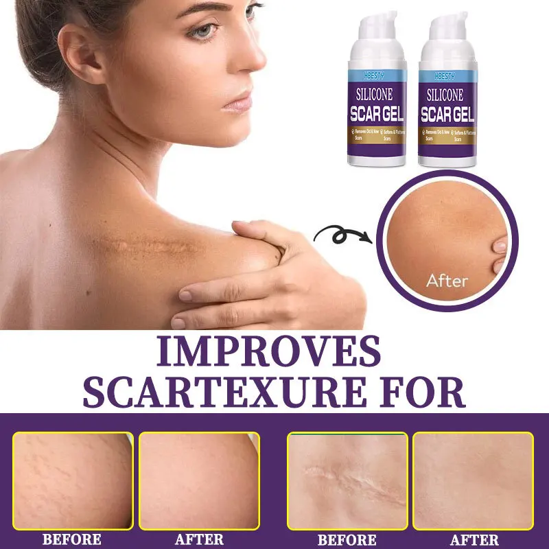 Żel silikonowy na blizny Szybkie odzyskanie po operacji Leczenie blizn Naprawa plam Zmiękczanie rozstępów Łagodzenie oparzeń Wybielanie Blizny Pielęgnacja