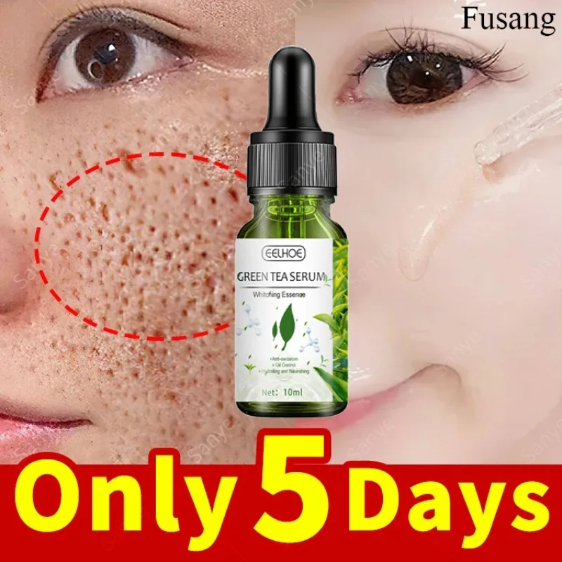 

Green Tea Oil Control Essence Face Pore Shrink Serum Improve Acne Blackheads Serum Remove Dark Spots Korean Whitening Skin Care