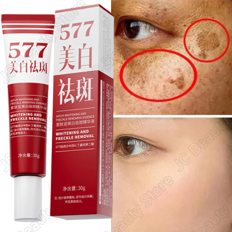 Whitening Freckle Serum Fade Pigmentation Moisturizing Brightening Improve Dull Anti Aging Remove Dark Spots Face Care Essence