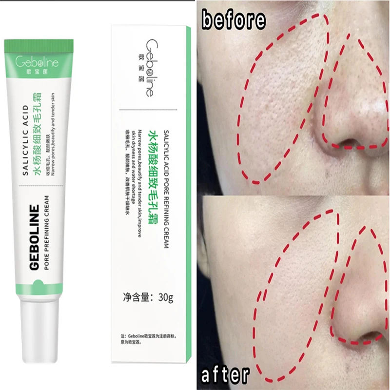 Salicylic Acid Pore Shrinking Cream Remove Exfoliating Bleaching Cream For Dark Skin Lightening Korean Face Skin Care Cosmetics