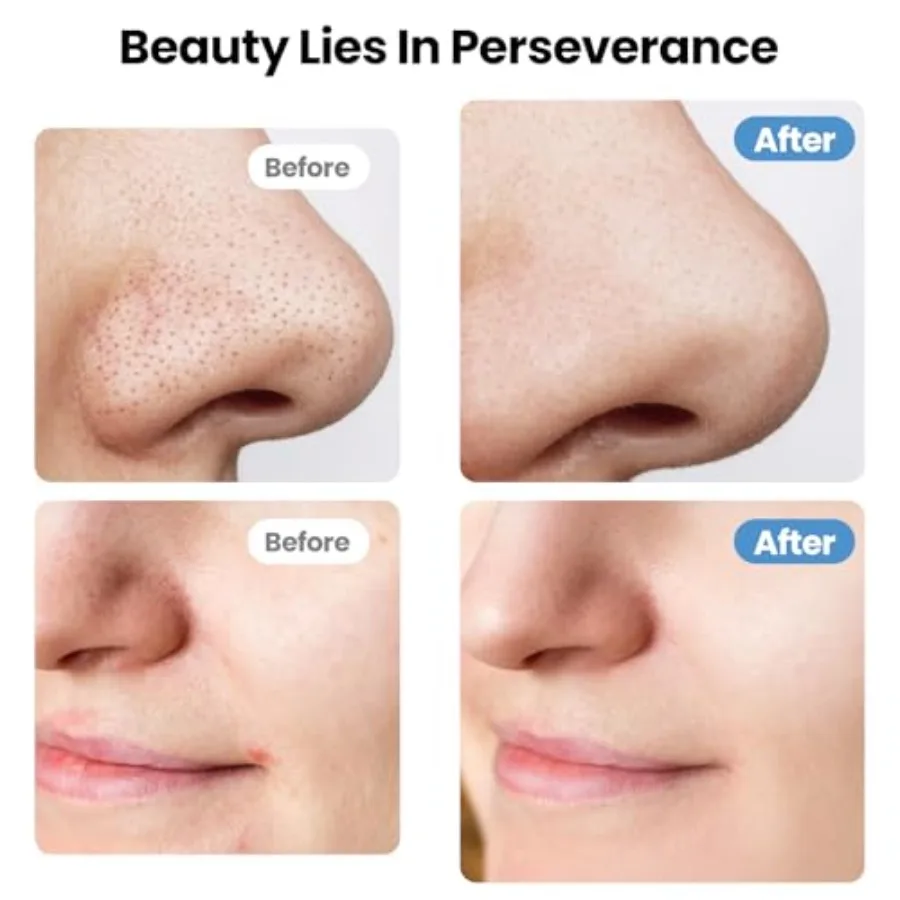 Skin Scrubber Face Spatula Skin Scrubber Pore CLEANER สีดํา Remover เครื่องมือสําหรับทําความสะอาดผิวหน้าอย่างล้ําลึก 4 โหมด Face Spatula US