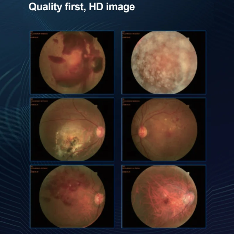 Portable Wide Field Eye Fundus  Ophthalmic Equipment Ophthalmology Digital OCT Optical Coherence Tomography