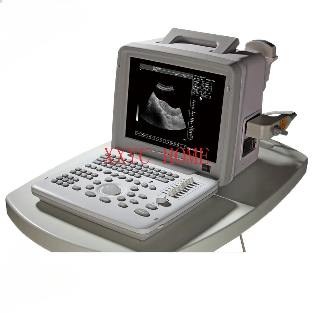 PC-based portable ultrasound machine medical ultrasound devices Sun-806X