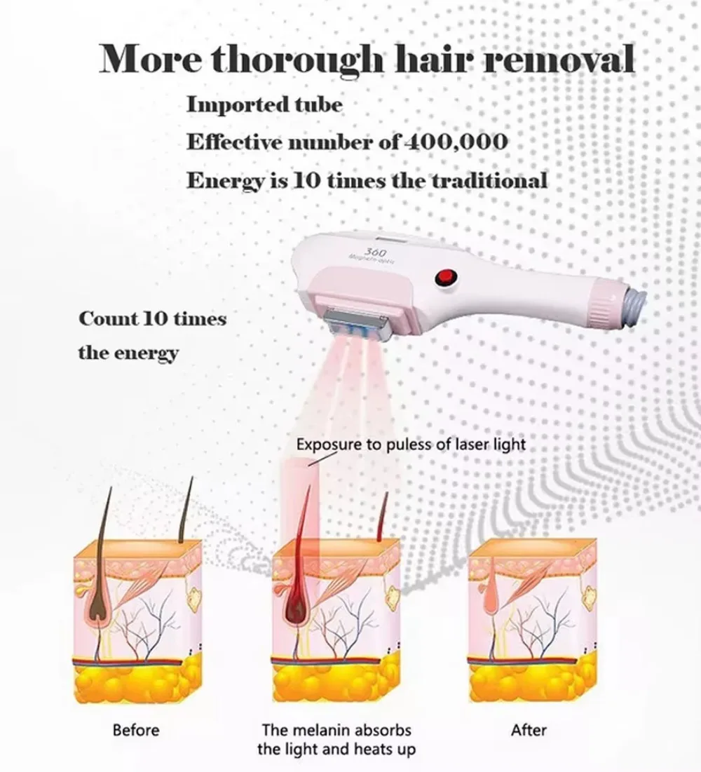 

The New Professional Permanent Lpl Opt Laser Hair Remove Machine Lpl E Light RF Diode Laser Hair Removal Machine (New)