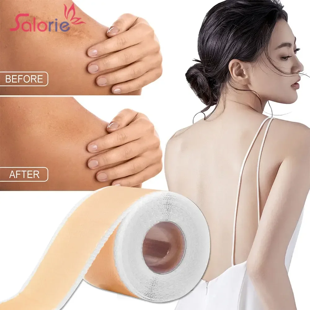 1/2pcs 150cm Silicone Gel Scar Sheet Patch Treatment Removal Tape Acne Trauma Burn Scar Cover Skin Repair Section Ear Beauty