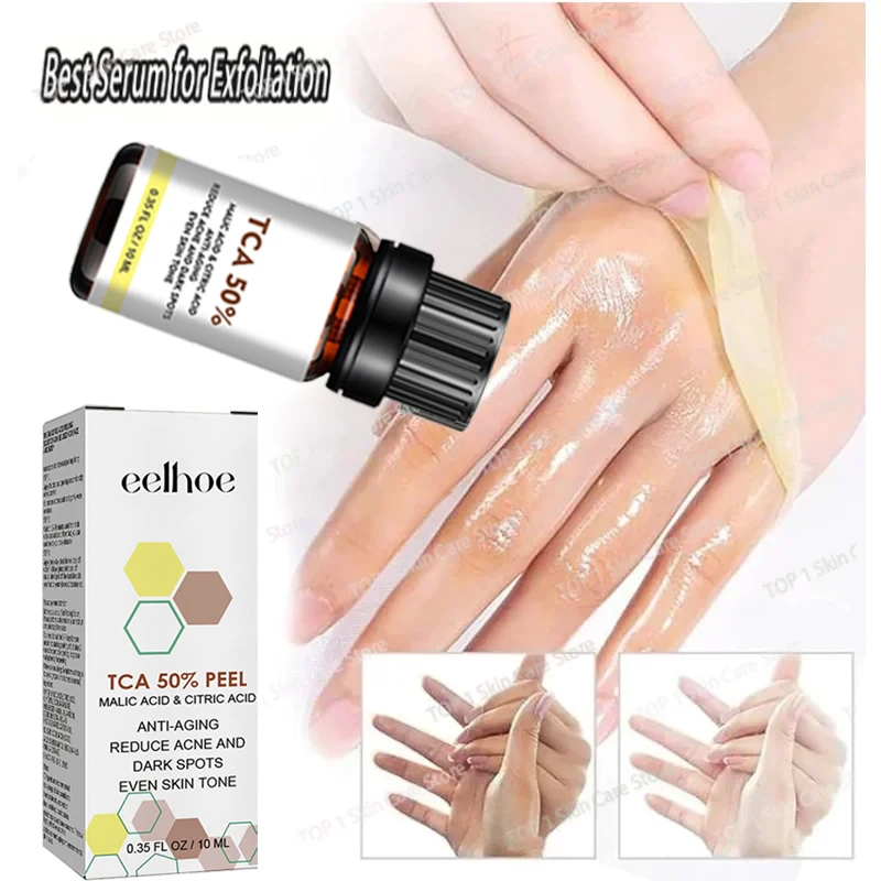 

Dilute melanin, acne, 50% TCA, high-quality chemical exfoliation, acidic skin beauty care