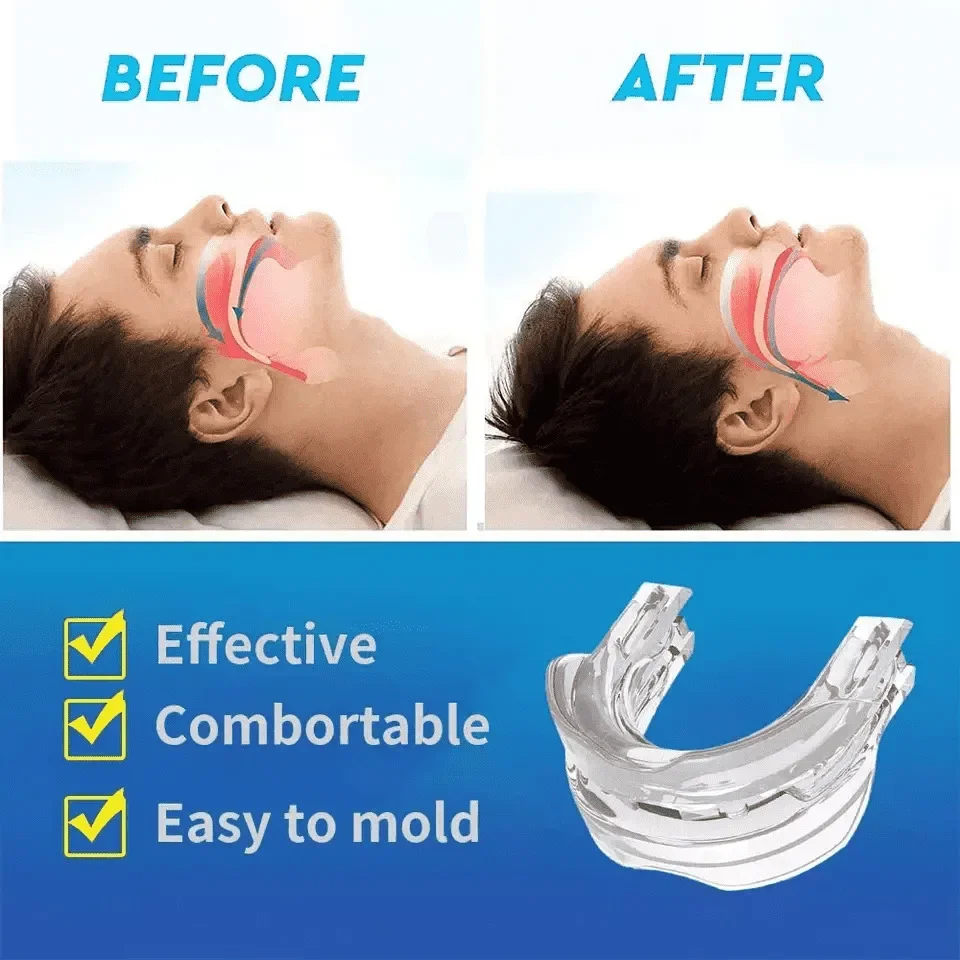 1Pc Anti-Snore Mouthpiece Bruxism Mouth Guard Improve Slee1Pc Aping Aid Braces Teeth Orthodontic Snoring Night Device Stop Snore