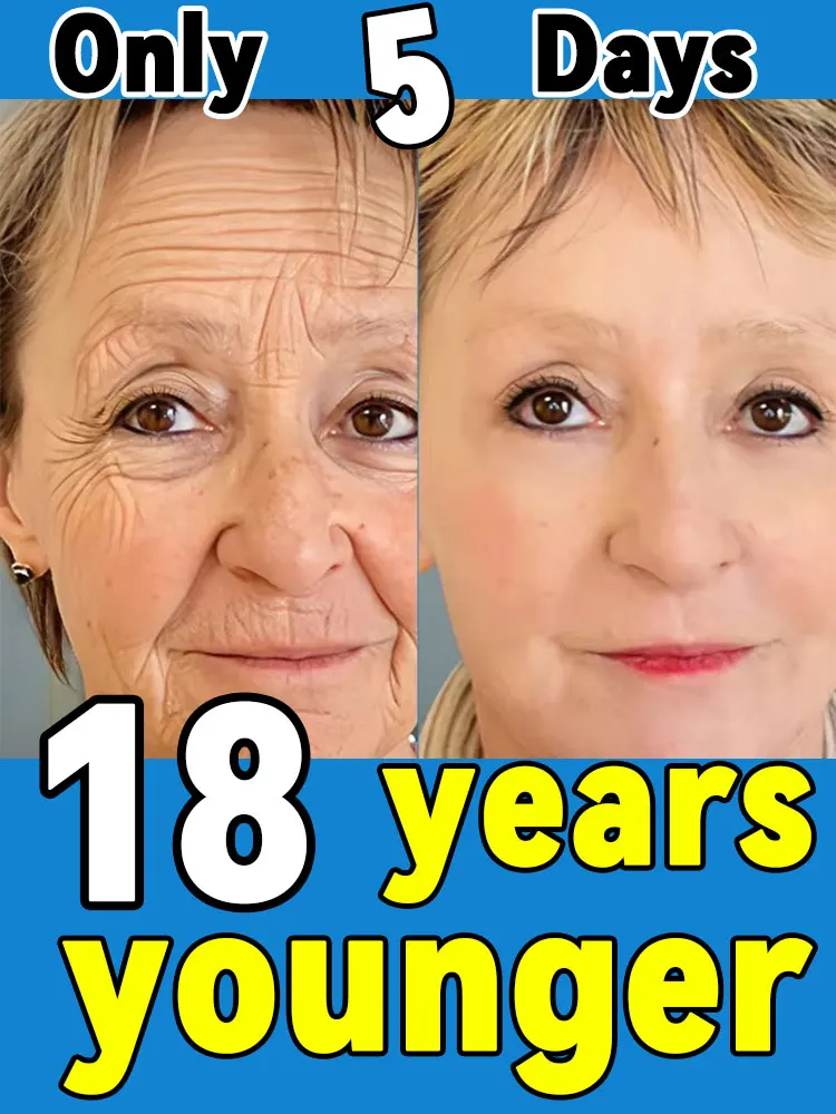 

Wrinkle Free, 18 Years Younger