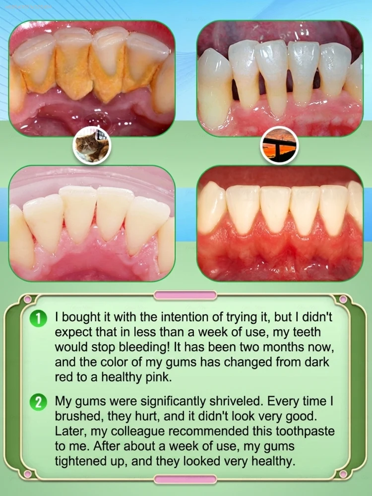Intensive Probiotic Gum Treatm - đánh giá và giá Teeth Whitening Paste