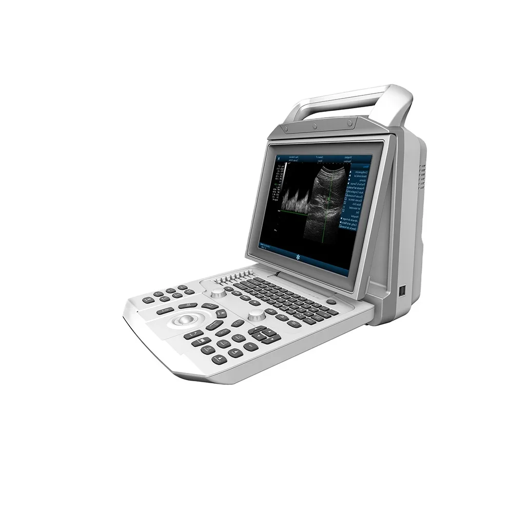 

Portable Ecografo Portatil Doppler Veterinary Ultrasound Equipment Medical Ultrasound Instruments Ultrasound Machine Price