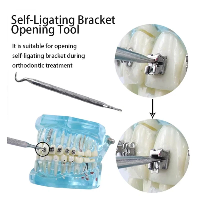 Tandheelkundige Orthodontische Zelfbeugel Brace Dubbele Open Close Tool Enkele Dubbele Uiteinden Opening Instrumenten Tandarts Tool